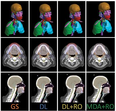 Validation of clinical acceptability of deep-learning-based automated segmentation of organs-at-risk for head-and-neck radiotherapy treatment planning